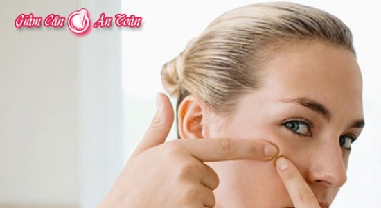 Cách trị mụn tại nhà hiệu quả nhất Cách trị mụn tại nhà hiệu quả nhất