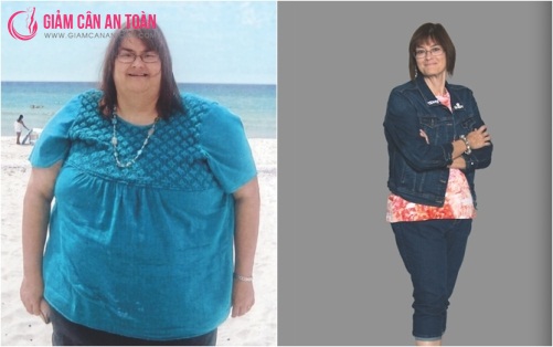 Gặp người phụ nữ giảm hiệu quả 110kg mà không cần ăn kiêng 5