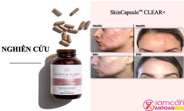 Hush & Hush Skin Capsule Clear+ làm dịu da đang bị kích ứng, giảm tình trạng viêm của mụn.